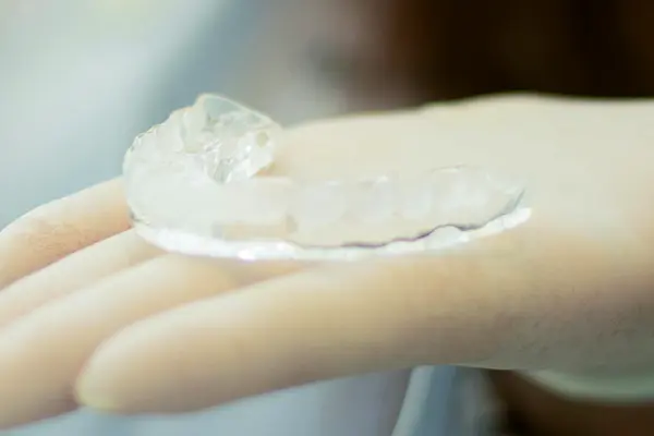 clear mouth guard in white gloved hand - treatment for teeth grinding in sleep