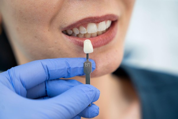 Want whiter teeth? Here’s what you need to know