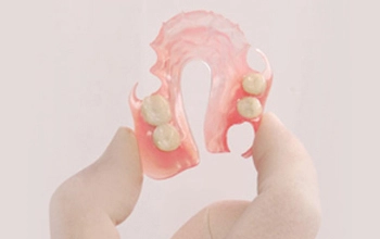 Flexible Partial Dentures