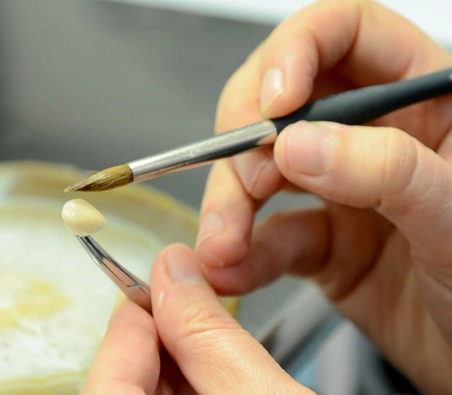 porcelain veneers in croydon