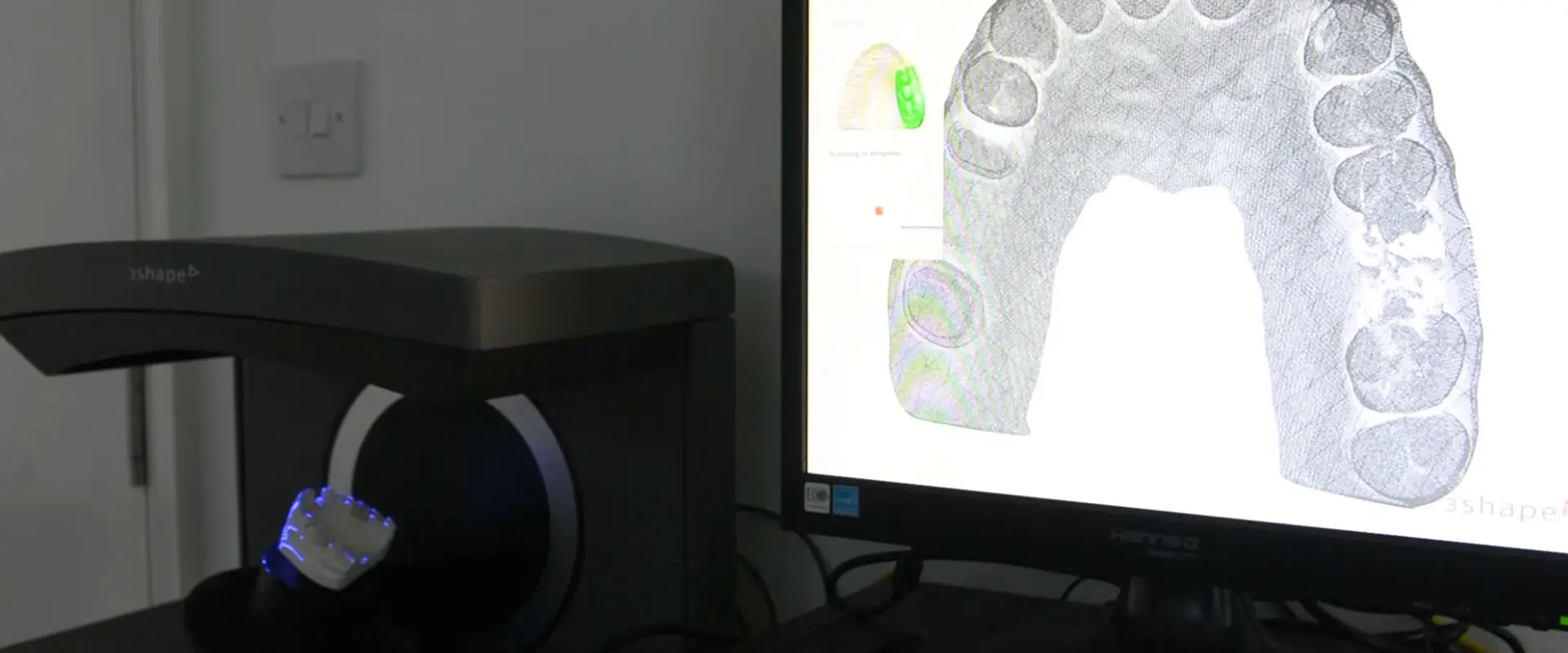 3d scanner for teeth
