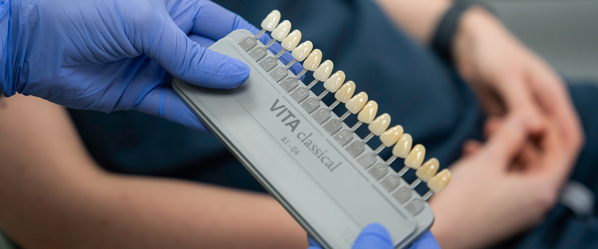 cosmetic dentistry in croydon - teeth shade guide