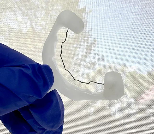 retainers south croydon: bonded wire retainer after braces held in gloved hand in front of window