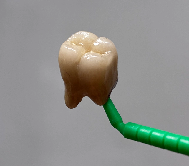 Dental Crown